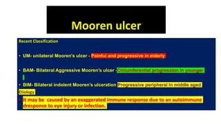 Mooren ulcer
Recent Classification
• UM- unilateral Mooren's ulcer - Painful and progressive in elderly
• BAM- Bilateral Aggressive Mooren’s ulcer -Circumferential progression in younger
• BIM- Bilateral indolent Mooren’s ulceration Progressive peripheral in middle aged
Etiology
• It may be caused by an exaggerated immune response due to an autoimmune
dresponse to eye injury or infection.
 