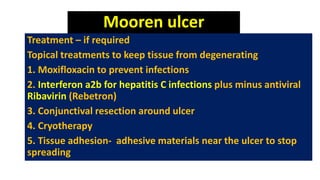 Mooren ulcer
Treatment – if required
Topical treatments to keep tissue from degenerating
1. Moxifloxacin to prevent infections
2. Interferon a2b for hepatitis C infections plus minus antiviral
Ribavirin (Rebetron)
3. Conjunctival resection around ulcer
4. Cryotherapy
5. Tissue adhesion- adhesive materials near the ulcer to stop
spreading
 