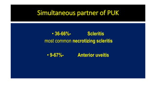 Simultaneous partner of PUK
• 36-66%- Scleritis
most common necrotizing scleritis
• 9-67%- Anterior uveitis
 