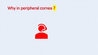 Why in peripheral cornea ?
 
