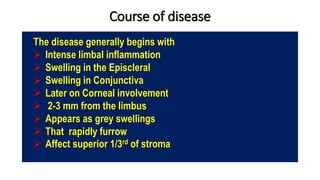 Course of disease
The disease generally begins with
 Intense limbal inflammation
 Swelling in the Episcleral
 Swelling in Conjunctiva
 Later on Corneal involvement
 2-3 mm from the limbus
 Appears as grey swellings
 That rapidly furrow
 Affect superior 1/3rd of stroma
 
