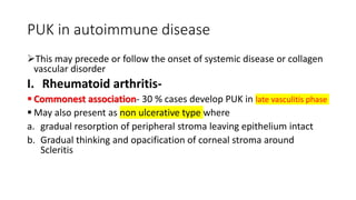 PUK in autoimmune disease
This may precede or follow the onset of systemic disease or collagen
vascular disorder
I. Rheumatoid arthritis-
 Commonest association- 30 % cases develop PUK in late vasculitis phase
 May also present as non ulcerative type where
a. gradual resorption of peripheral stroma leaving epithelium intact
b. Gradual thinking and opacification of corneal stroma around
Scleritis
c. Severe dry eye and central corneal melting
 