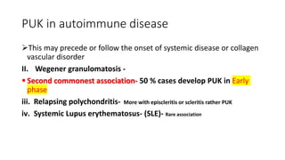 PUK in autoimmune disease
This may precede or follow the onset of systemic disease or collagen
vascular disorder
II. Wegener granulomatosis -
 Second commonest association- 50 % cases develop PUK in Early
phase
iii. Relapsing polychondritis- More with episcleritis or scleritis rather PUK
iv. Systemic Lupus erythematosus- (SLE)- Rare association
 