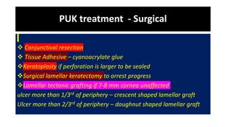 PUK treatment - Surgical
 Conjunctival resection
 Tissue Adhesive – cyanoacrylate glue
Keratoplasty if perforation is larger to be sealed
Surgical lamellar keratectomy to arrest progress
Lamellar tectonic grafting if 7-8 mm cornea unaffected
ulcer more than 1/3rd of periphery – crescent shaped lamellar graft
Ulcer more than 2/3rd of periphery – doughnut shaped lamellar graft
 