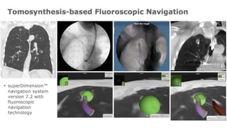Peripheral Pulmonary Lession for diagnostic | PPTX