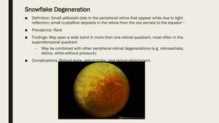 Snowflake Degeneration
■ Definition: Small yellowish dots in the peripheral retina that appear white due to light
reflection; small crystalline deposits in the retina from the ora serrata to the equator[2]
■ Prevalence: Rare
■ Findings: May span a wide band in more than one retinal quadrant, most often in the
superotemporal quadrant
– May be combined with other peripheral retinal degenerations (e.g. retinoschisis,
lattice, white-without pressure)
■ Complications: Retinal tears, retinal holes, and retinal detachment.
 