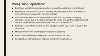 Paving-Stone Degeneration
■ Definition: Multiple rounded punched-out areas of choroidal and retinal atrophy
■ Prevalence: present in 4%–28% of patients; often bilateral; similar prevalence in
men and women; increasingly common with age
■ Characteristics: Lesions are yellow-white in color and may reveal underlying
choroidal vessels due to the sclera being partly visible through the atrophic choroid;
discrete margins that may be pigmented; may become confluent[7]
■ Findings: Located between the ora and equator with the size of one to several disc
diameters
■ More common in the inferonasal and temporal quadrants
■ Large choroidal vessels may be seen running through the base
■ Complications: Benign lesions not associated with complications
 