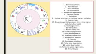 1. Retinal detachment.
2. Retinal drusen.
3. Lattice with holes.
4. Full thickness tear.
5. Honeycomb degeneration.
6. Preretinal fibrosis.
7. Retinal tuft.
8. Unifocal hypertrophy of the retinal pigment epithelium.
9. Haemorrhage.
10. Grouped congenital hypertrophy of the retinal pigment
epithelium. (bear track)
11. Pearl degeneration.
12. Retinoschisis
13. Atrophic retinal hole.
14. Snail track degeneration.
15. Dark without pressure.
16. Snowflake degeneration.
17. White without pressure.
18. Flap tear
19. Operculated retinal tear.
20. Paving stone degeneration.
21. Lattice degeneration.
22. Peripheral cystoid degeneration.
23. Retinal dialysis.
 