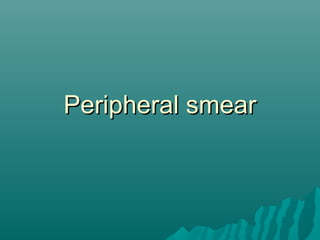 Peripheral smearPeripheral smear
 