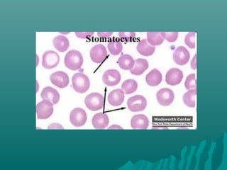 Peripheral smear