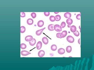 Peripheral smear