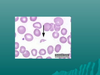 Peripheral smear