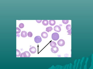 Peripheral smear