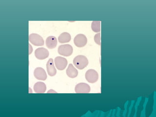 Peripheral smear