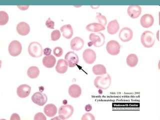 Peripheral smear