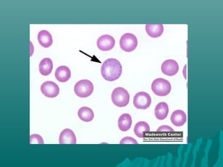 Peripheral smear