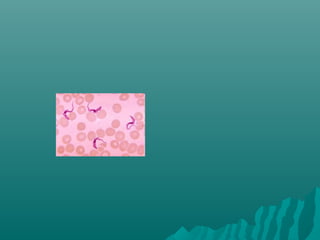 Peripheral smear