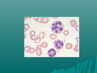 Peripheral smear