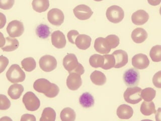 Peripheral smear