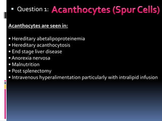  Question 1:
Acanthocytes are seen in:
• Hereditary abetalipoproteinemia
• Hereditary acanthocytosis
• End stage liver disease
• Anorexia nervosa
• Malnutrition
• Post splenectomy
• Intravenous hyperalimentation particularly with intralipid infusion
 