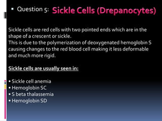 Question 5:
Sickle cells are red cells with two pointed ends which are in the
shape of a crescent or sickle.
This is due to the polymerization of deoxygenated hemoglobin S
causing changes to the red blood cell making it less deformable
and much more rigid.
Sickle cells are usually seen in:
• Sickle cell anemia
• Hemoglobin SC
• S beta thalassemia
• Hemoglobin SD
 