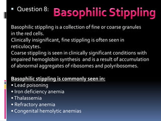  Question 8:
Basophilic stippling is a collection of fine or coarse granules
in the red cells.
Clinically insignificant, fine stippling is often seen in
reticulocytes.
Coarse stippling is seen in clinically significant conditions with
impaired hemoglobin synthesis and is a result of accumulation
of abnormal aggregates of ribosomes and polyribosomes.
Basophilic stippling is commonly seen in:
• Lead poisoning
• Iron deficiency anemia
•Thalassemia
• Refractory anemia
• Congenital hemolytic anemias
 