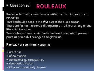  Question 16:
Rouleaux formation is a common artifact in the thick area of any
blood film.
True Rouleaux is seen in the thin part of the blood smear.
There are four or more red cells organized in a linear arrangement
like a stack of coins.
True rouleaux formation is due to increased amounts of plasma
proteins primarily fibrinogen and globulins.
Rouleaux are commonly seen in:
• Infections
• Inflammation
• Monoclonal gammopathies
• Neoplastic diseases
• AIHA warm antibody disease
 