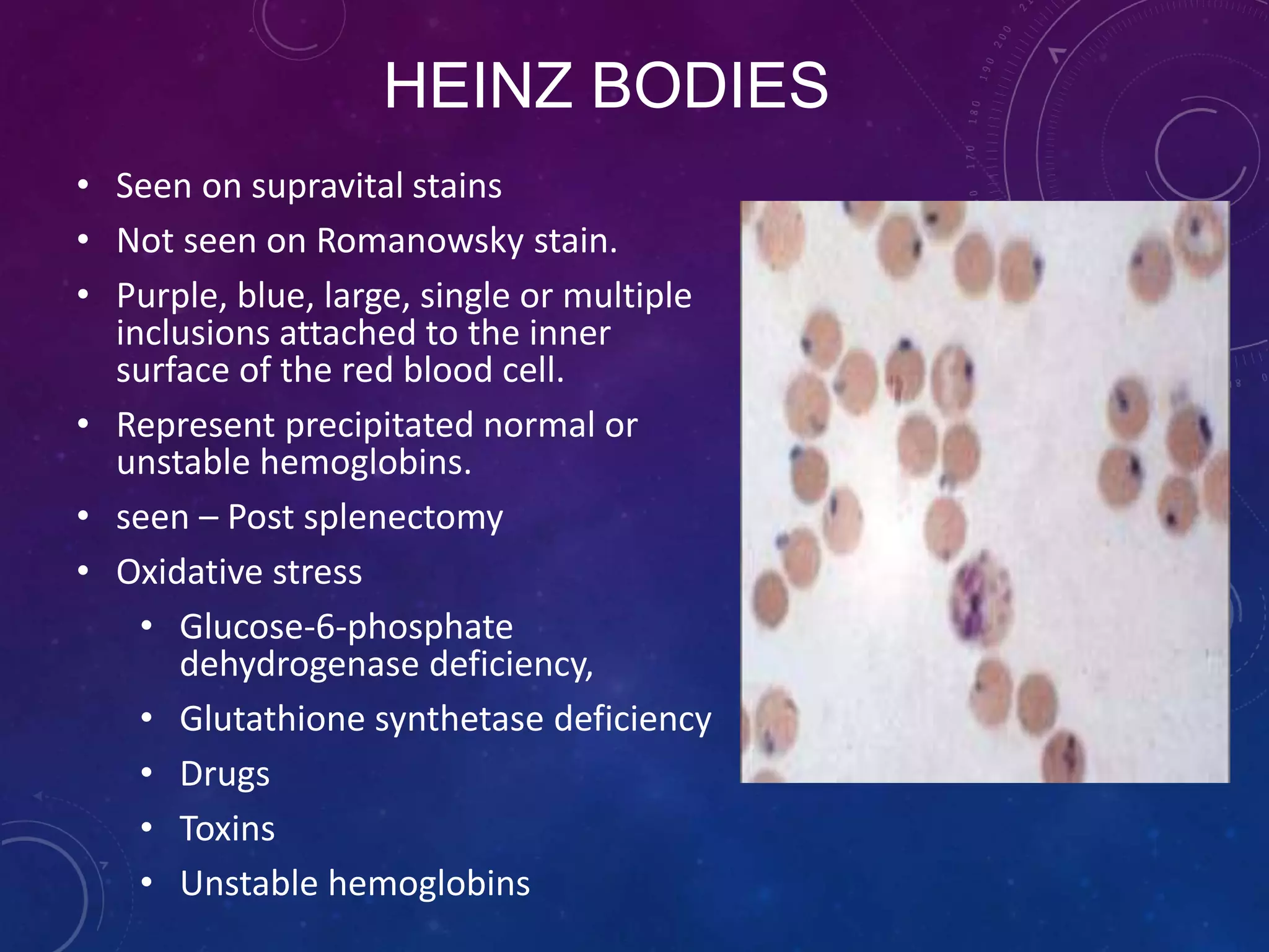 Peripheral smear