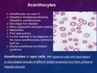 Acanthocytes or spur cells, are spherical cells with blunt-tipped
or club-shaped spicules of different lengths projecting from their surface at
irregular intervals.
Acanthocytes
 Acanthocytes are seen in
 Hereditary Abetalipoproteinemia
Hereditary acanthocytosis
 End stage liver disease
 Micro angiopathic hemolytic anemia
 Malnutrition
 Post splenectomy
 it is the hallmark in the diagnosis of
the neuro acanthocytosis syndrome
such as
 Chorea-acanthosis and Mcleod
syndrome
 