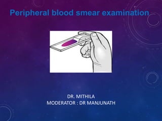 Peripheral blood smear examination
DR. MITHILA
MODERATOR : DR MANJUNATH
 