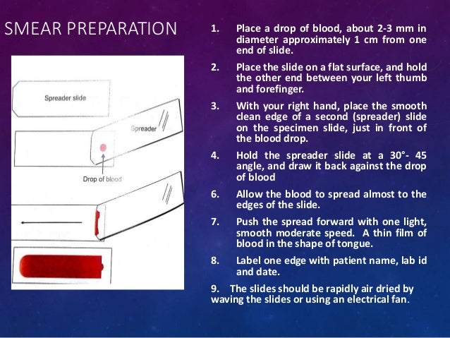 Peripheral smear