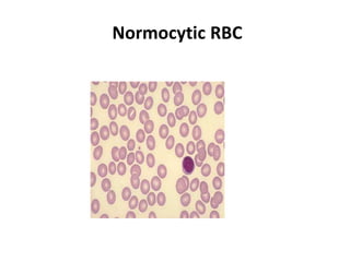 Peripheral smear | PPTX