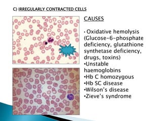 Peripheral Smear technique and reporting | PPTX