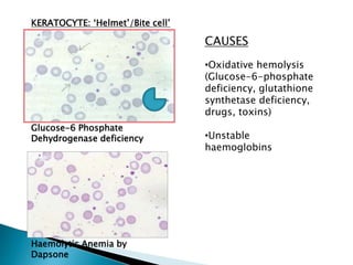 glutathione synthetase deficiency peripheral smear technique and reporting Integrative Peptides Epitalon-Pinealon, Oral