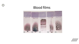 Blood films
 