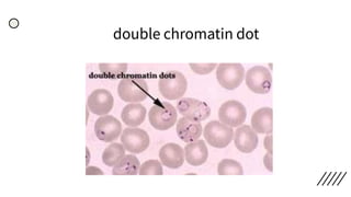 double chromatin dot
 