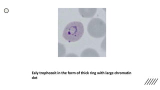Ealy trophozoit in the form of thick ring with large chromatin
dot
 