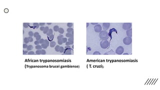 African trypanosomiasis
(Trypanosoma brucei gambiense)
American trypanosomiasis
( T. cruzi);
 