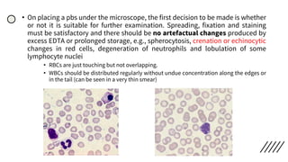 • On placing a pbs under the microscope, the first decision to be made is whether
or not it is suitable for further examination. Spreading, fixation and staining
must be satisfactory and there should be no artefactual changes produced by
excess EDTA or prolonged storage, e.g., spherocytosis, crenation or echinocytic
changes in red cells, degeneration of neutrophils and lobulation of some
lymphocyte nuclei
• RBCs are just touching but not overlapping.
• WBCs should be distributed regularly without undue concentration along the edges or
in the tail (can be seen in a very thin smear)
 