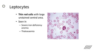 Leptocytes
• Thin red cells with large
unstained central area.
• Seen in
– Severe iron deficiency
anemia
– Thaleasaemia
 