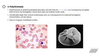 4. Polychromasia
• Polychromasia or polychromatophilia describes red cells that are pinkish-blue as a consequence of uptake
both of eosin, by hemoglobin, and of basic dyes, by residual nucleic acids.
• considerably larger than mature erythrocytes and, as a consequence of a reduced hemoglobin
concentration, are less dense
• have an irregular, multilobate surface
 