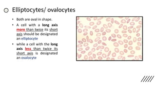 Elliptocytes/ ovalocytes
• Both are oval in shape.
• A cell with a long axis
more than twice its short
axis should be designated
an elliptocyte
• while a cell with the long
axis less than twice its
short axis is designated
an ovalocyte
 