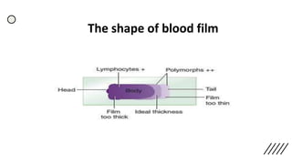 The shape of blood film
 
