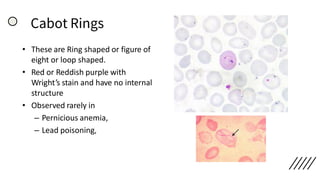 Cabot Rings
• These are Ring shaped or figure of
eight or loop shaped.
• Red or Reddish purple with
Wright’s stain and have no internal
structure
• Observed rarely in
– Pernicious anemia,
– Lead poisoning,
 