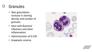 Granules
• Toxic granulation-
increase in staining
density and number of
granules
• Seen with Bacterial
infections and other
inflammation
• Administration of G-CSF
• Anaplastic anemia
 