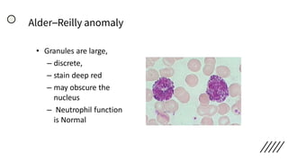 Alder–Reilly anomaly
• Granules are large,
– discrete,
– stain deep red
– may obscure the
nucleus
– Neutrophil function
is Normal
 