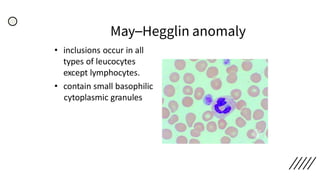 May–Hegglin anomaly
• inclusions occur in all
types of leucocytes
except lymphocytes.
• contain small basophilic
cytoplasmic granules
 