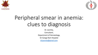 Peripheral smear in anemia:
clues to diagnosis
Dr. Jasmita,
Consultant,
Department of Hematology,
Sir Ganga Ram Hospital
drjasmita@gmail.com
SGRH
 
