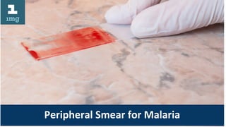 Peripheral Smear for Malaria
 