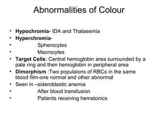 Abnormalities of Colour
• Hypochromia- IDA and Thalasemia
• Hyperchromia-
• Spherocytes
• Macrocytes
• Target Cells: Central hemoglobin area surrounded by a
pale ring and then hemoglobin in peripheral area
• Dimorphism :Two populaions of RBCs in the same
blood film-one normal and other abnormal
• Seen in –sideroblastic anemia
• After blood transfusion
• Patients receiving hematonics
 